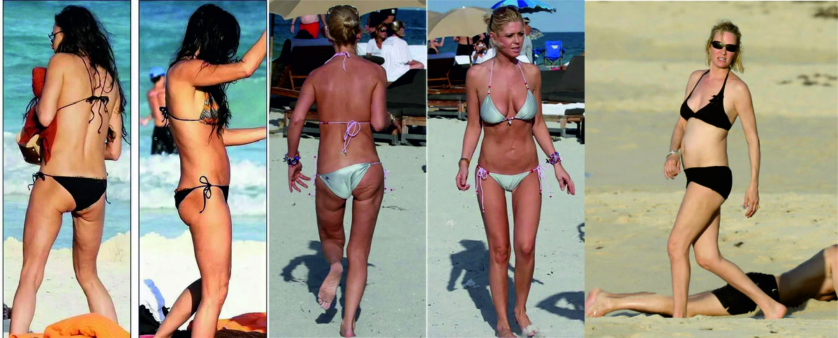 Худенькие? Да. Красиво ли это?.....