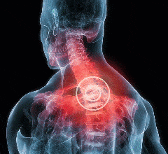 Слабые мышцы позвоночного корсета