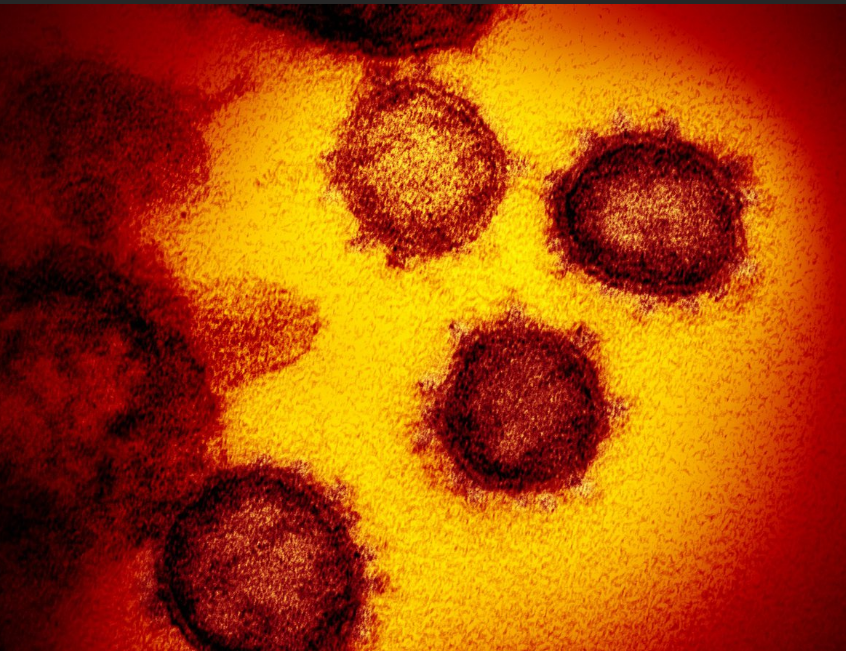 COVID-19 Изображение получено с помощью просвечивающего электронного микроскопа.  На поверхности вируса видны шипы (что дает коронавирусу его название, означающее "корона"). 

