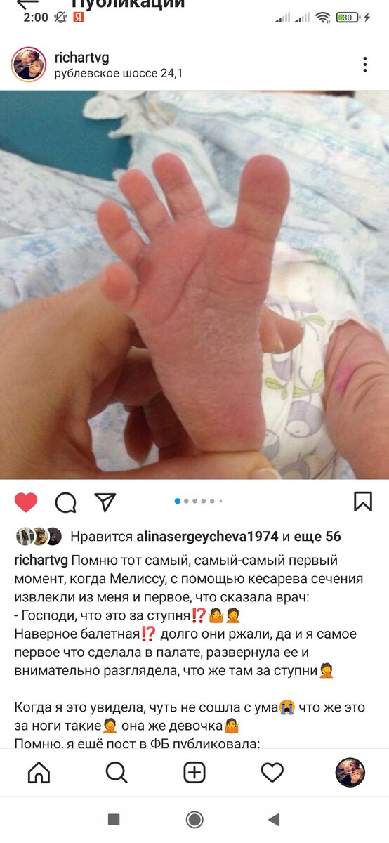 Вот она, стопа гимнастки🤣🤪