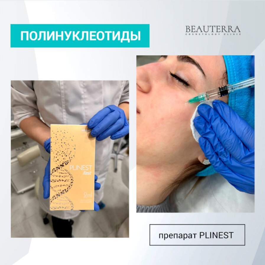 Особенности препаратов для биоревитализации Plinest