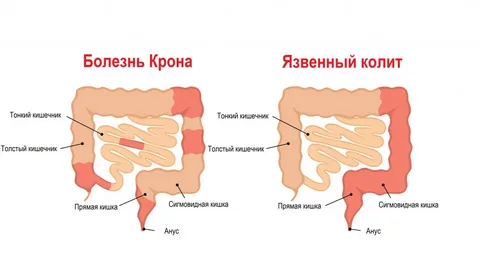 взято из общего доступа