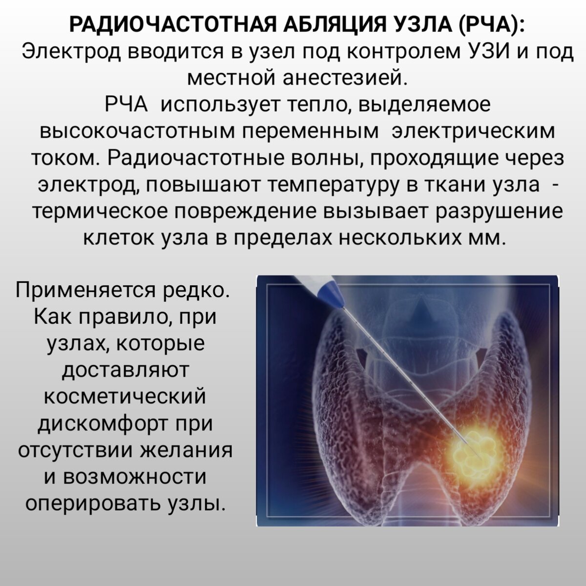 Удаление узла щитовидной железы как проходит Многоузловой нетоксический зоб: причины, симптомы и лечение в ФНКЦ ФМБА