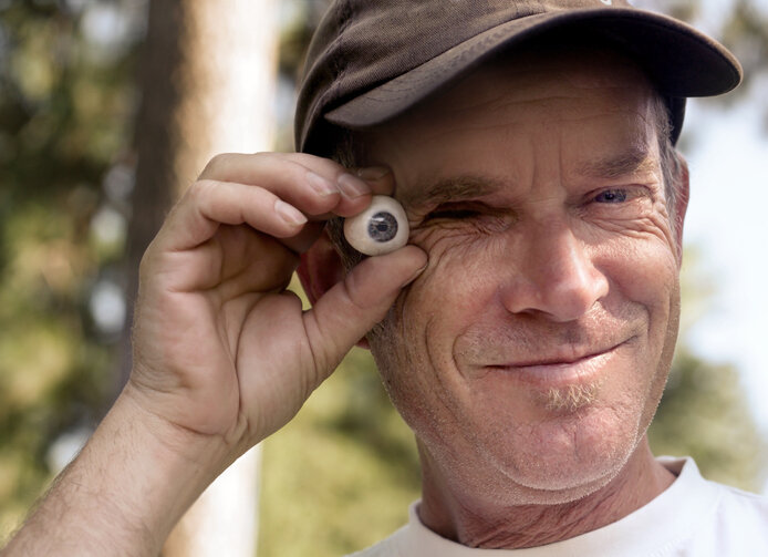 человек со стеклянным глазом. стеклянный глаз протез. глазной протез стеклянный. человек со стеклянным глазом. современный протез глаза.