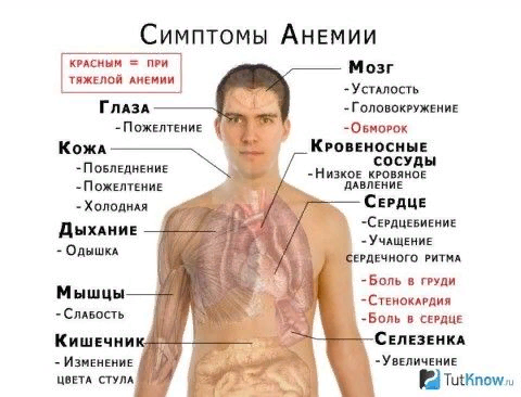 Изменение стула при анемии