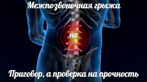 Возможно ли лечение грыжи позвоночника без операции в Санкт Петербурге?
