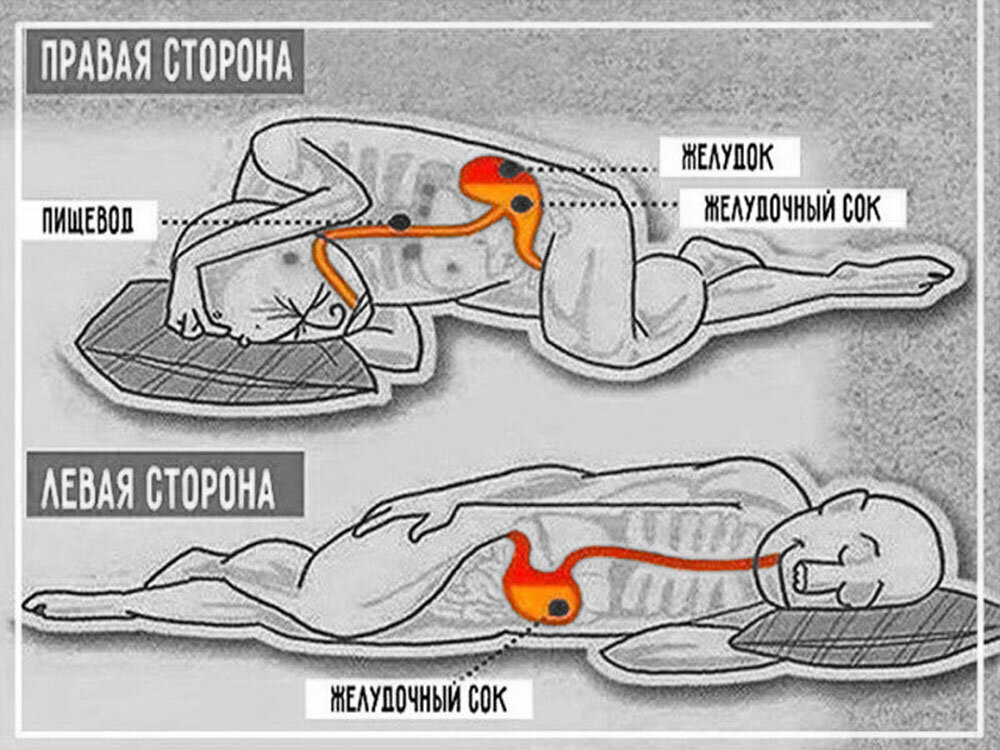 На каком боку лучше спать. На каком боку спать. На каком боку надо лежать. На каком боку лежать при изжоге. На каком боку лучше спать при изжоге.