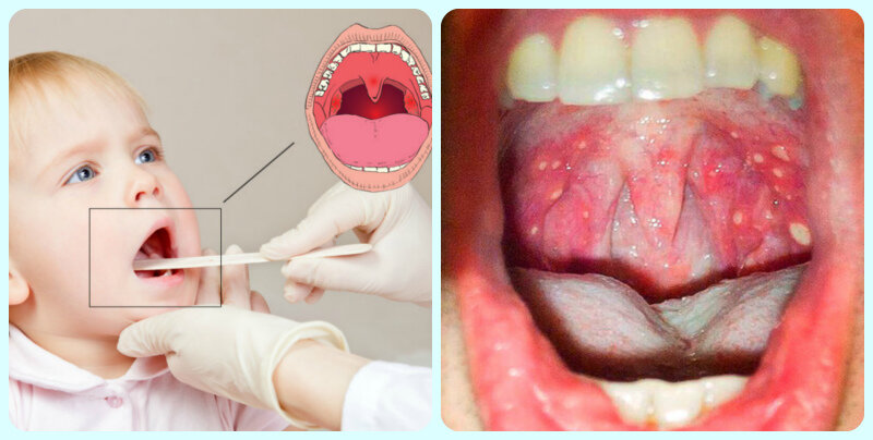 Фото: getty images