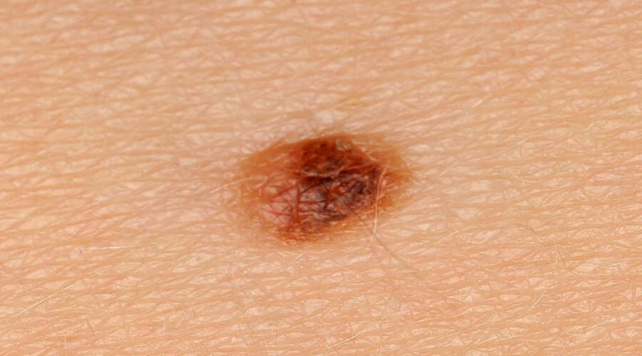 Фото  http://ponedelnik.info