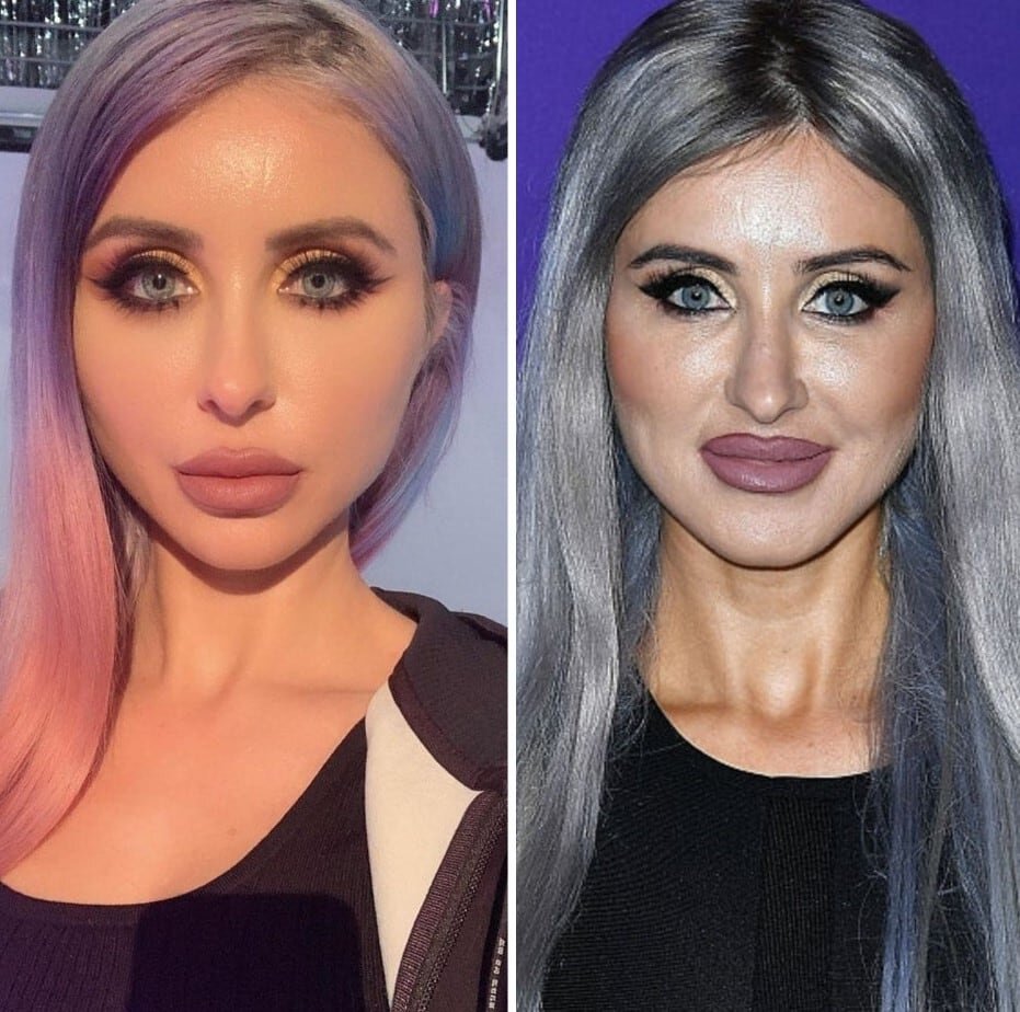-2