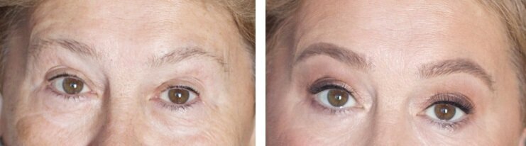 Брови до и после. На примере видно, что брови после оформления совсем не выглядят нарисованными, они смотрятся вполне натурально.