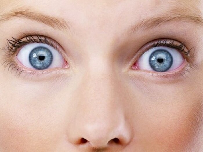 Фото Человек не моргает.