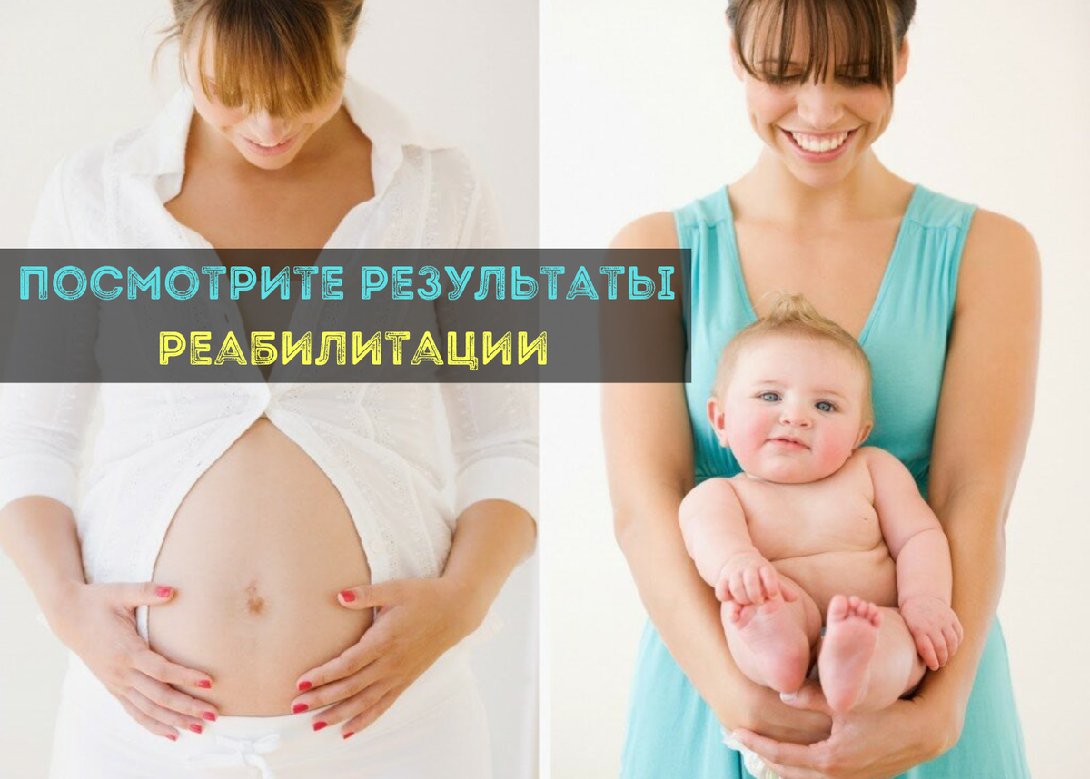 Стимуляция родов