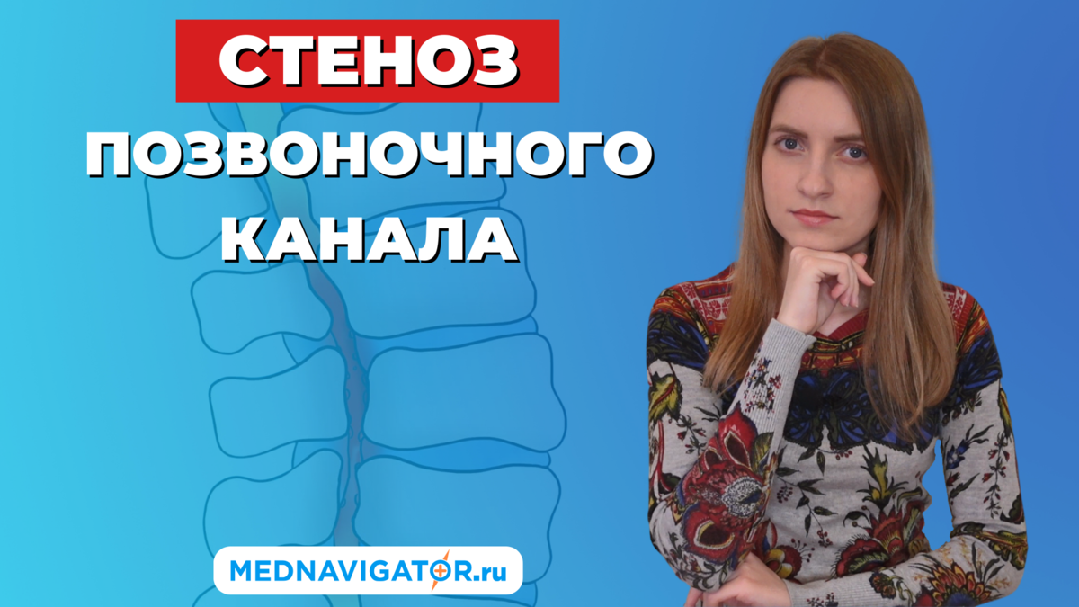 Канал без причины. Позвоночник. Фораминальный стеноз поясничного отдела позвоночника.