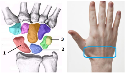  3 из 8 запястных костей, которые ломаются чаще остальных