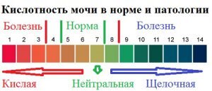   При сдаче анализов мочи в результатах величина pH определяет кислотно-щелочной баланс исследуемого материала и диагностирует уровень здоровья человека, в частности, состояние мочеполовой системы.-2