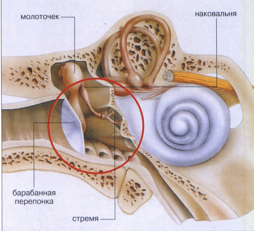 Гнойный отит