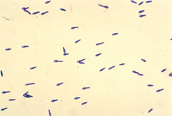 Clostridium Botulinum