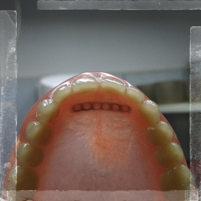 Армирование частичное