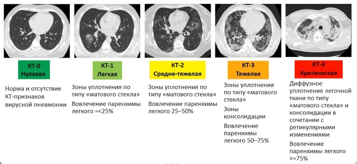 Что означает кт картина