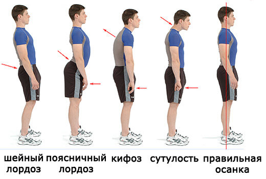 5 упражнений для правильной осанки