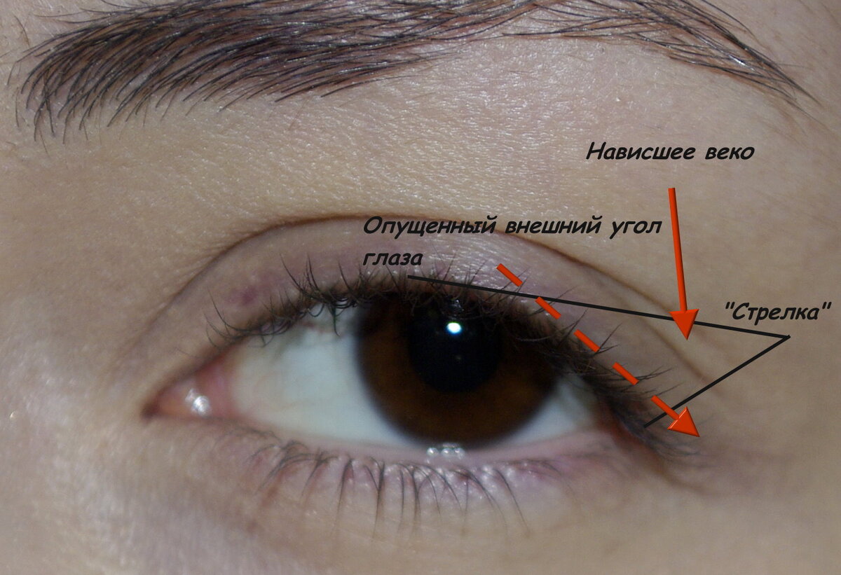 Как уменьшить расстояние между глазом и бровью