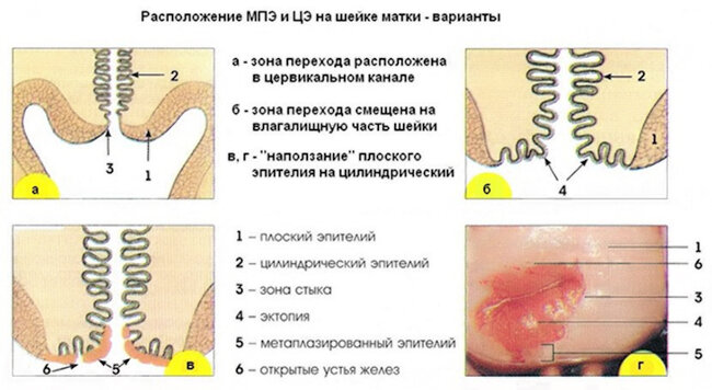 Нужно ли лечиться?