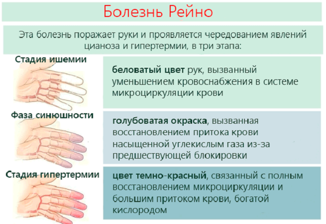 Побледнение кожных покровов свидетельствует