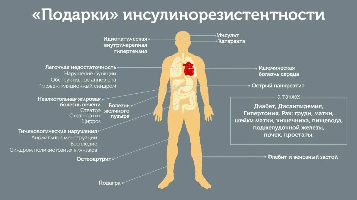 Определите приступ какого заболевания случился с больным если наблюдается следующая картина