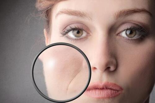 
Исключить из своей жизни вышеперечисленное невозможно, рано или поздно это затрагивает всех, а вот смягчить или оттянуть процесс увядания кожи, возможно.
