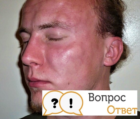 Почему краснеет лицо после алкоголя у женщин? - статьи «Веримед»