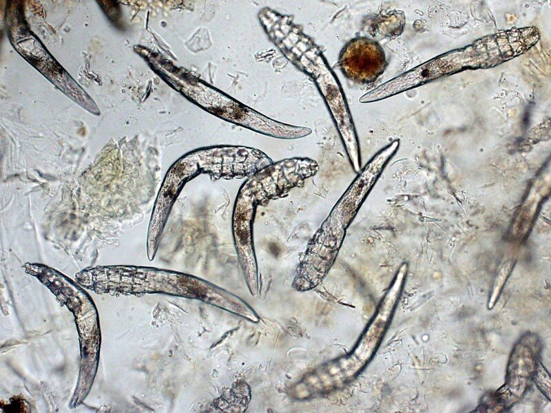 Таким видит врач Demodex foliculorum под микроскопом.
