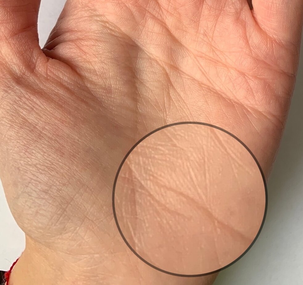 Аллергия и сигареты