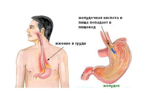 Одышка при остеохондрозе: причины и симптомы. Лечение остеохондроза в Москве по доступным ценам