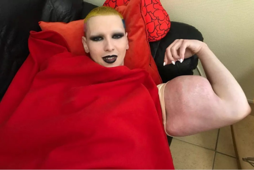 -2