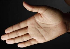 Наличие отметки на правой руке говорит об особенностях в судьбе: