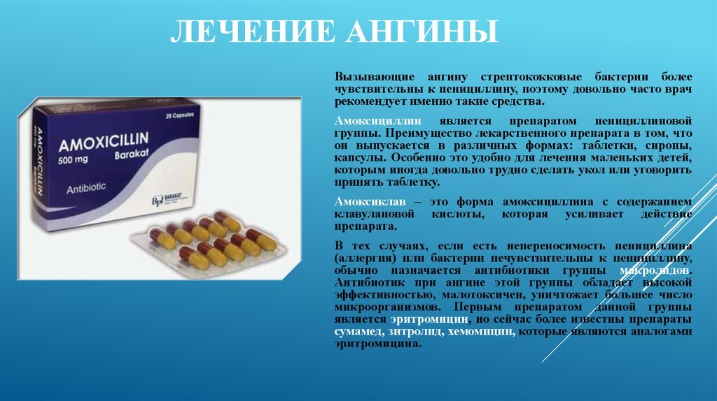 фл. препараты для лечения горла. ангина быстро и эффективно препараты. алгоритм лечения ангины. ангина быстро и эффективно препараты.
