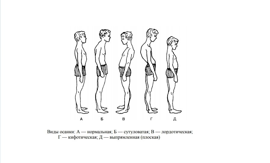 «Не сутулься!»: как исправить осанку? | Аптека ФАРМЭКОНОМ