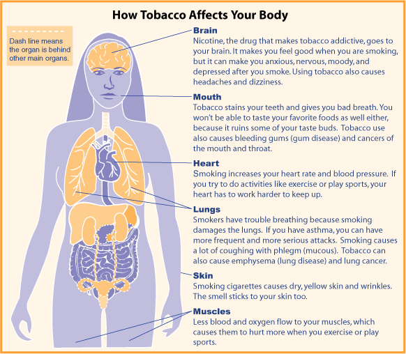 Moнедула. Общественное достояние. http://www.girlshealth.gov/substance/smoking/index.cfm
