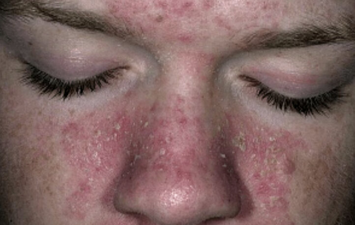 Фото взято из интернета