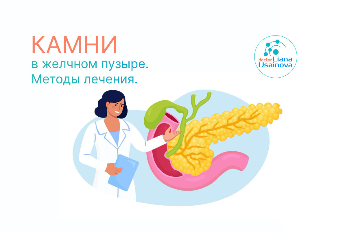 Камни в желчном пузыре. Методы лечения. Рассказывает врач эндокринолог ...