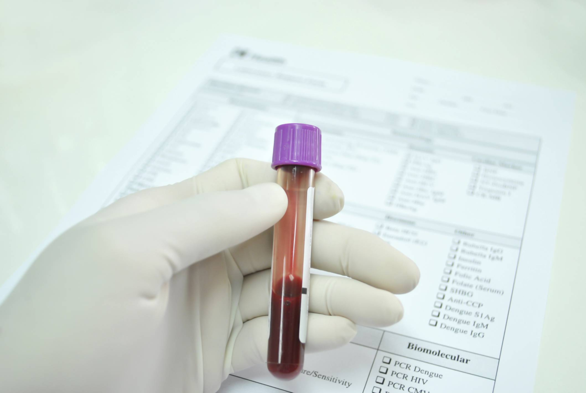 Пробирки для забора крови на гликированный гемоглобин. ОАК анализ пробирка. Биохимические исследования крови пробирка. Пробирки для клинического анализа крови у животных.