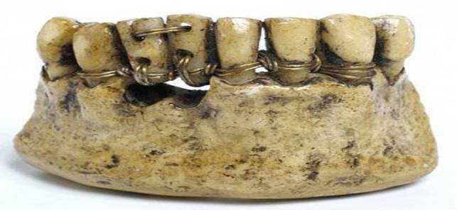Как лечили зубы в древности? | МИР ИСТОРИИ - WOH | Дзен