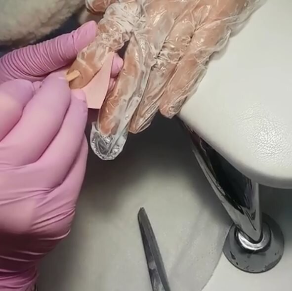 -2
