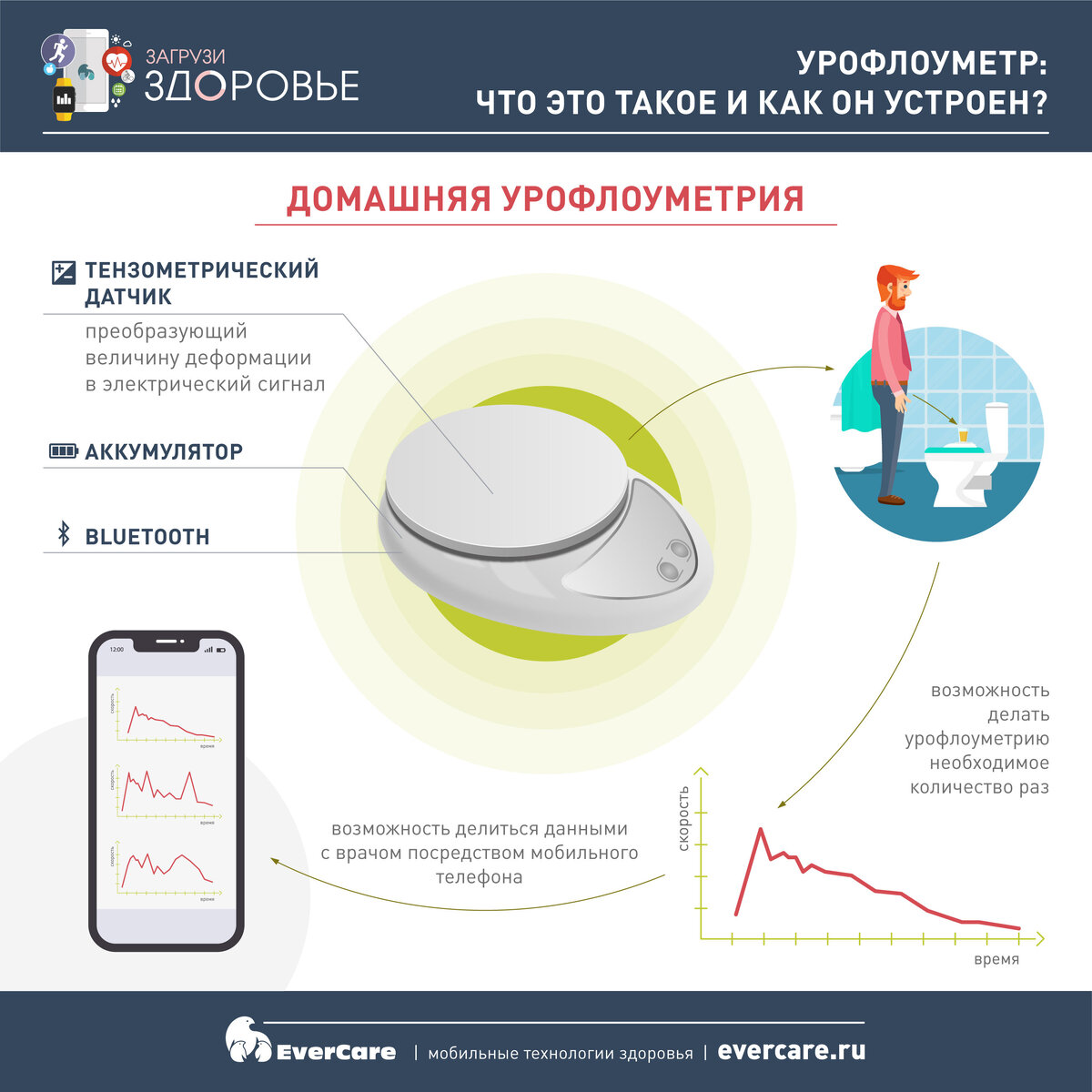 Урофлоуметр: что это такое и как он устроен