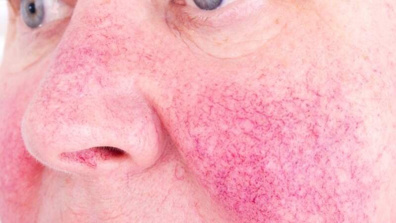 Кожные заболевания: психосоматика | Анатомия здоровья | Дзен