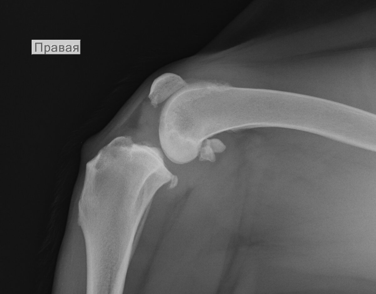 Начальные признаки остеоартрита у алабая на фоне нестабильности коленного сустава. Причина - разрыв передней крестовидной связки.