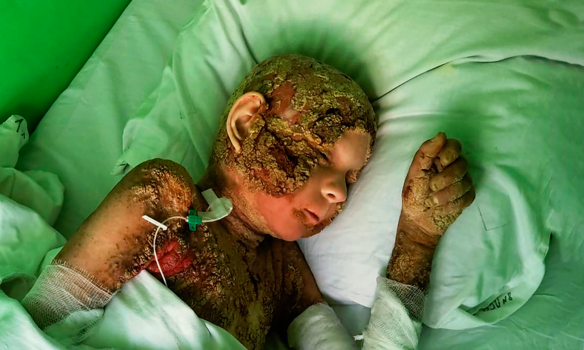 Кирилл Перчик, подопечный фонда "Алёша"