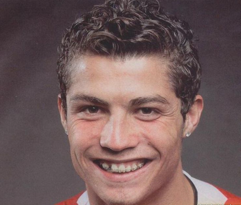 Никогда не стесняйтесь своей улыбки!