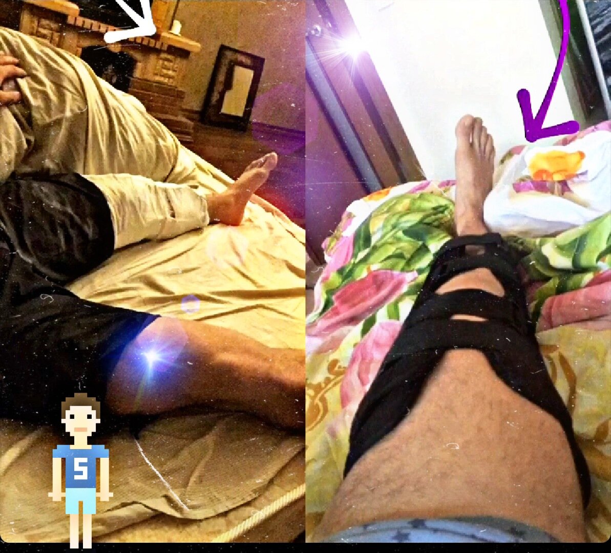 Больные колени капаклы. дом2 новости